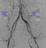 artery ovarian